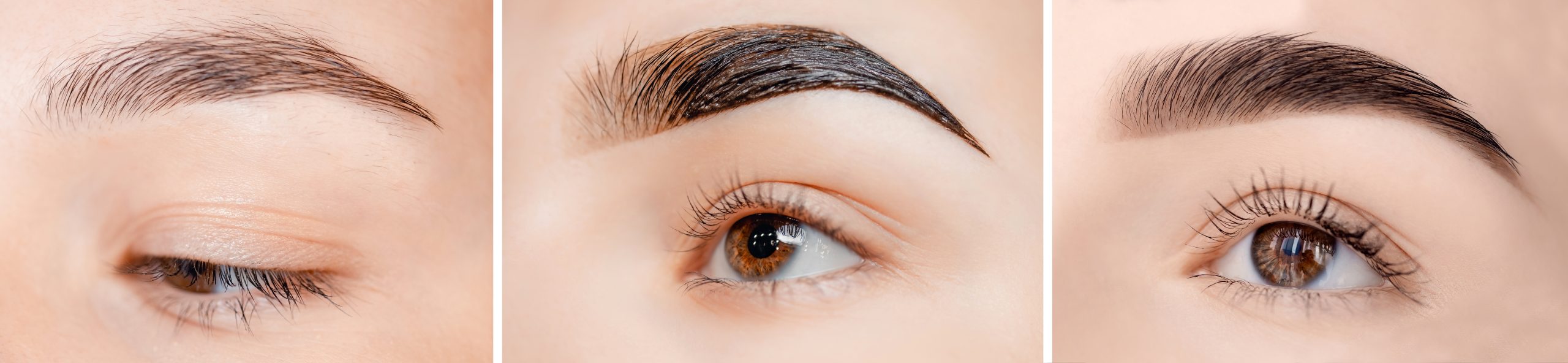 Collage,Beauty,Procedure,Eyebrow,Care,,Beauty,Procedures,For,Women.